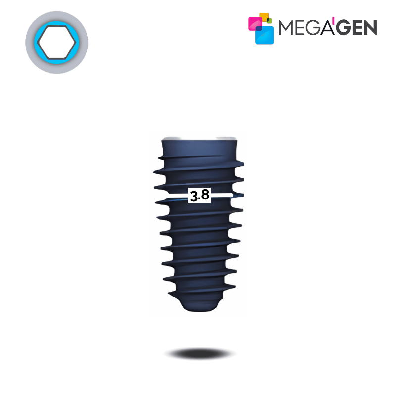 MegaGen AnyRidge Implantat | Kern: Ø 3,8 mm | Ø 5,0 mm | Länge: 15,0 mm MegaGen AnyRidge Implantat | Kern: Ø 3,8 mm | Ø 5,0 mm | Länge: 15,0 mm