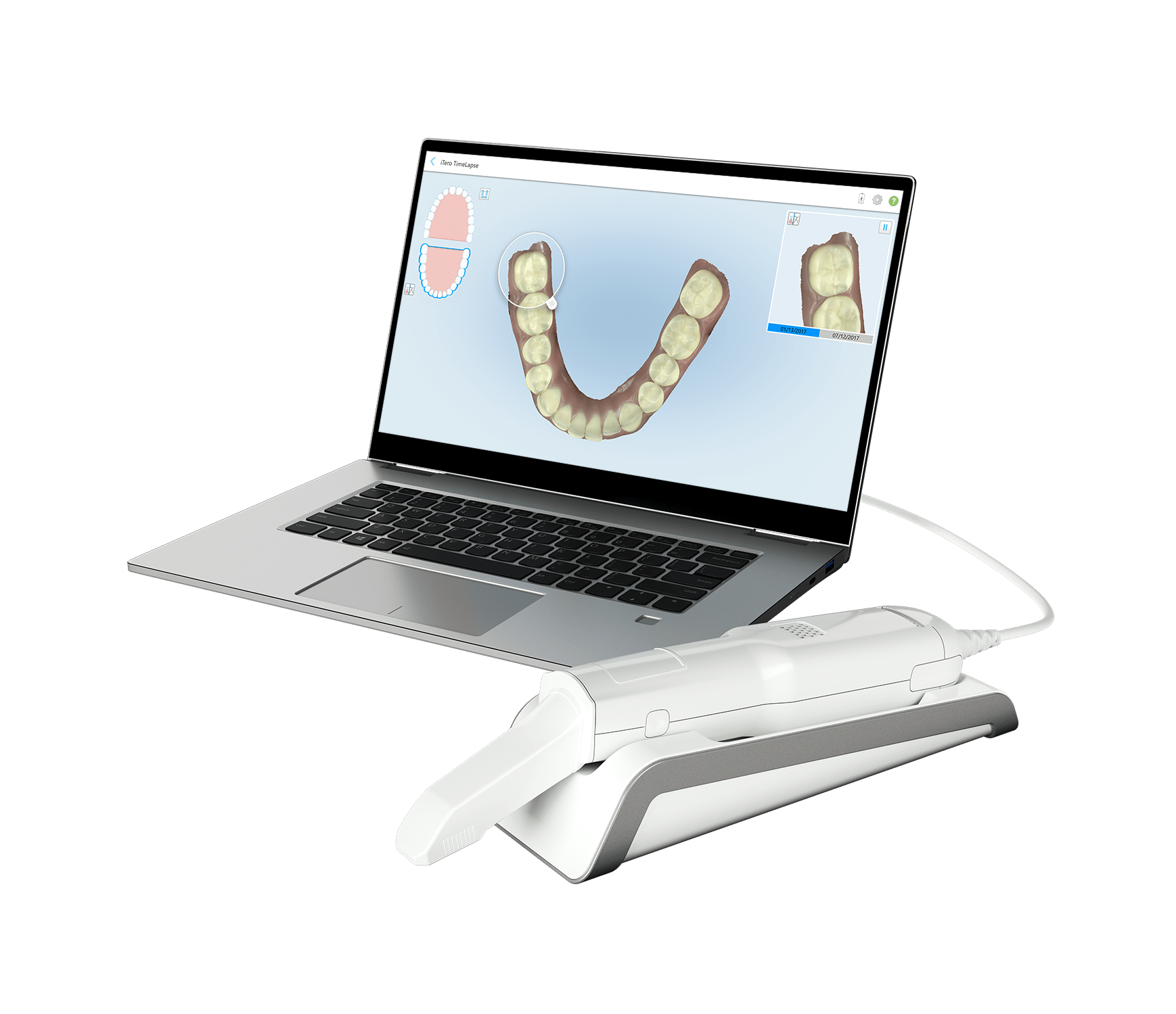 iTero Intraoralscanner Element Flex 
